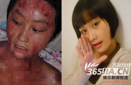 官二代追求不成将少女毁容 心理学家称或是父母纵容所致